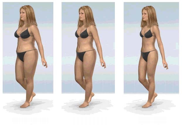 svorio svorio metimas kaip prarasti riebų pilvuką