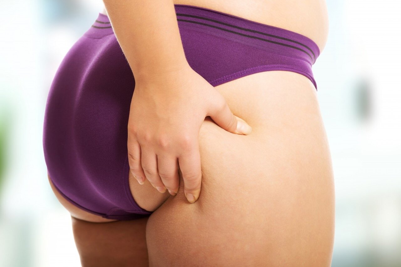 kaip numesti riebalus ant viršutinės kojos daugiau nei 50 moterų negali numesti svorio