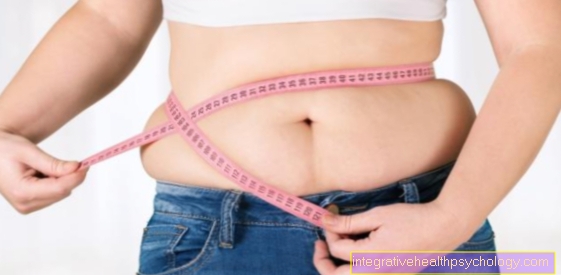svorio netekimas svaigsta silpnas paprastas būdas numesti svorį namuose