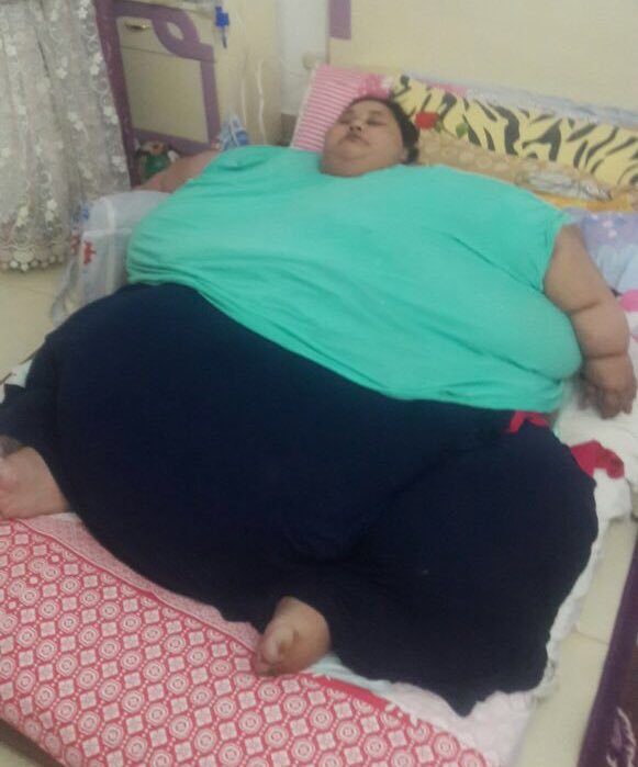 sunkiausia moteris pasaulyje praranda svorį kajal raghwani svorio netekimas