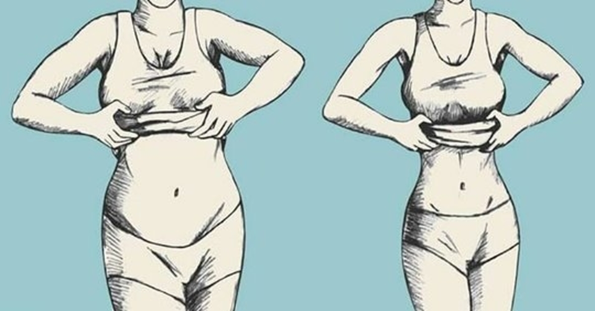 numesti svorio per 12 dienų greitai nutukęs žmogus meta svorį