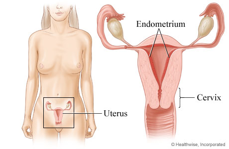 svorio metimas ir endometriozė